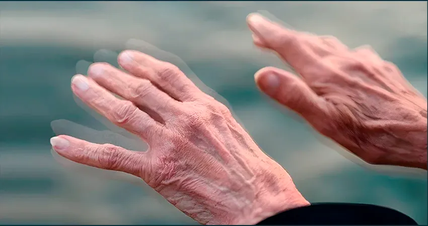 Canabinóides no Tratamento dos Sintomas da Doença de Parkinson